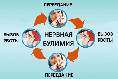 Лечение булимии в Псебае